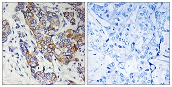 Carbonyl Reductase 1 rabbit pAb