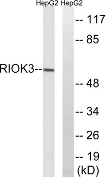 SUDD rabbit pAb Antibody