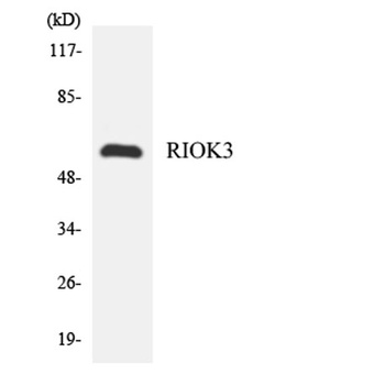 SUDD rabbit pAb Antibody