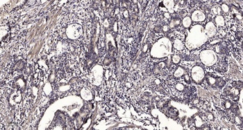 SUDD rabbit pAb Antibody