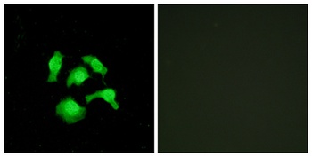 TSC-22 rabbit pAb Antibody