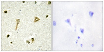 TSC-22 rabbit pAb Antibody