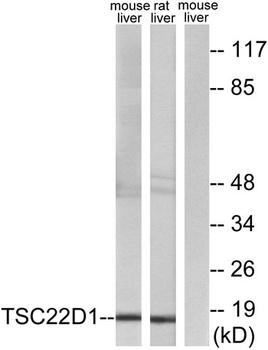 TSC-22 rabbit pAb Antibody
