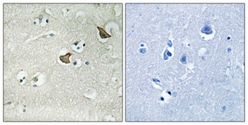 CCK-AR rabbit pAb Antibody