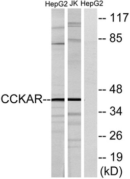 CCK-AR rabbit pAb Antibody