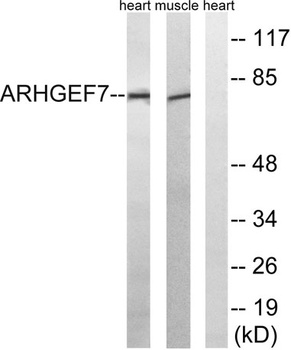 PIXβ rabbit pAb Antibody