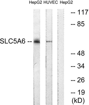 SMVT rabbit pAb Antibody