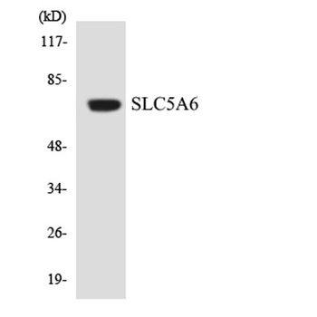 SMVT rabbit pAb Antibody