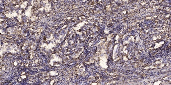 SMVT rabbit pAb Antibody