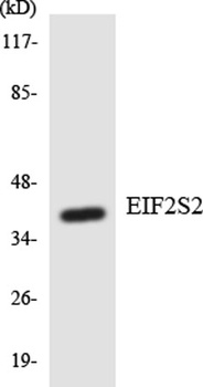 eIF2β rabbit pAb Antibody