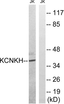 TALK-2 rabbit pAb Antibody