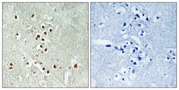 CRIF1 rabbit pAb Antibody