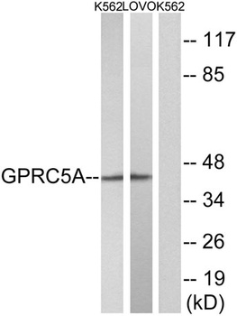 RAI3 rabbit pAb Antibody