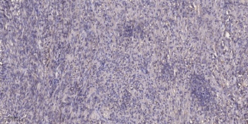 StARD13 rabbit pAb Antibody