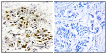 MEK Kinase-6 rabbit pAb