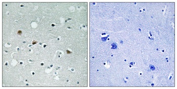 LATS1/2 (phospho Thr1079/1041) rabbit pAb Antibody