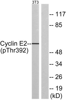 Cyclin E2 (phospho Thr392) rabbit pAb