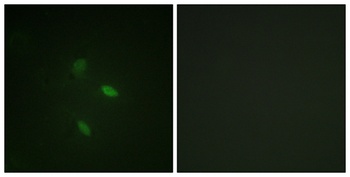 Cyclin E2 rabbit pAb Antibody
