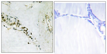 Cyclin E2 rabbit pAb Antibody