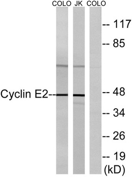 Cyclin E2 rabbit pAb Antibody