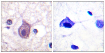 CD4 (phospho Ser433) rabbit pAb