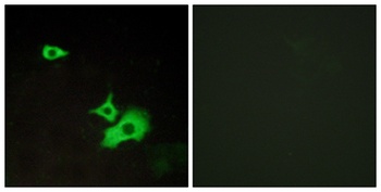 GPR37L1 rabbit pAb Antibody