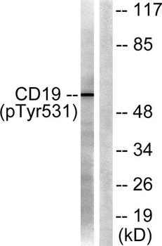 CD19 (phospho Tyr531) rabbit pAb Antibody