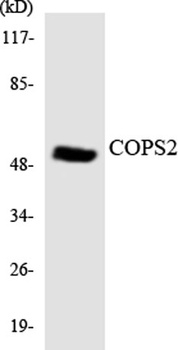TRIP15 rabbit pAb Antibody
