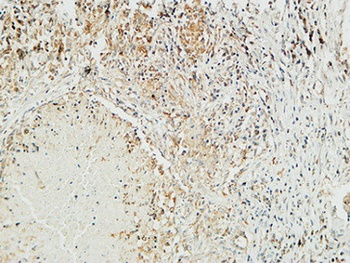 Mucin 16 rabbit pAb Antibody