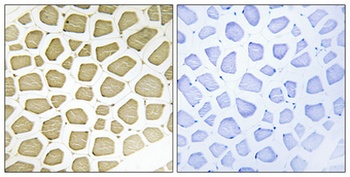 CYP7B1 rabbit pAb Antibody