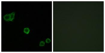 CPI-17 rabbit pAb Antibody