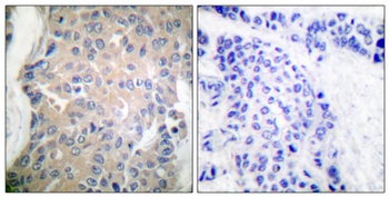 CPI-17 rabbit pAb Antibody