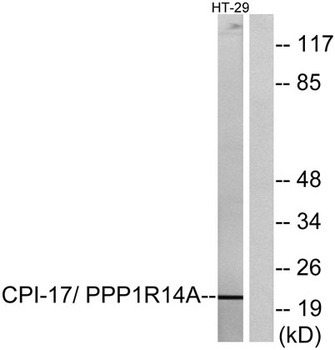CPI-17 rabbit pAb Antibody