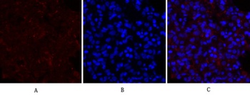 PERK rabbit pAb Antibody