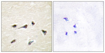 AKAP 250 rabbit pAb Antibody