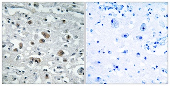 GASP-1 rabbit pAb Antibody