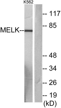 MELK rabbit pAb Antibody