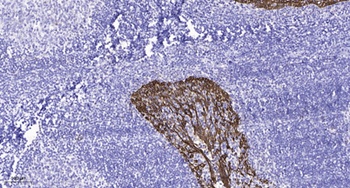 MELK rabbit pAb Antibody