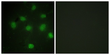 TLK1 rabbit pAb Antibody