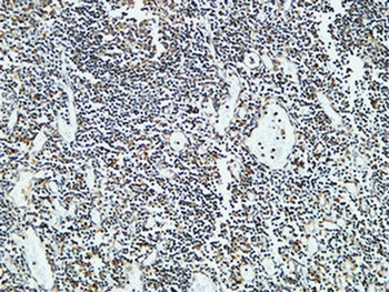 Cdc25B rabbit pAb Antibody
