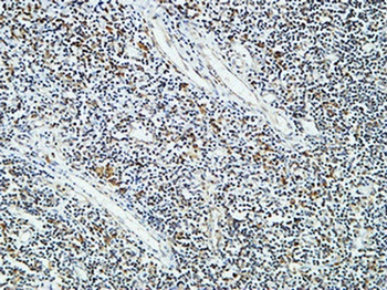 Cdc25B rabbit pAb Antibody