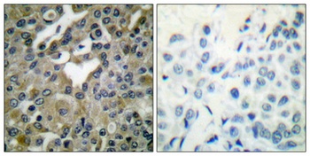 Cdc25B rabbit pAb Antibody