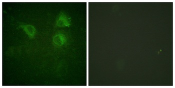 Cdc25B rabbit pAb Antibody