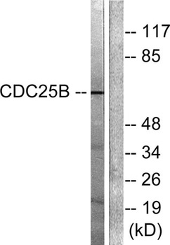 Cdc25B rabbit pAb Antibody