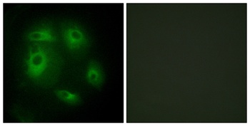 DLEC1 rabbit pAb Antibody