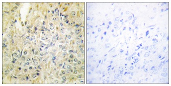 DLEC1 rabbit pAb Antibody