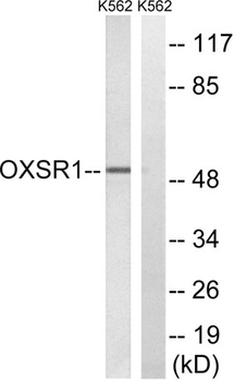 OXSR1 rabbit pAb Antibody
