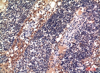 CD156c rabbit pAb Antibody