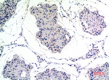 Thrombospondin 2 rabbit pAb Antibody