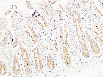 Thrombospondin 2 rabbit pAb Antibody